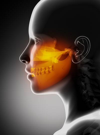 3D Diagram of the Maxillofacial area where the Sinus is