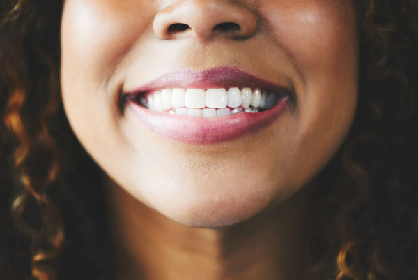 Close up of a beautiful woman smiling at Placentia Oral Surgery in Placentia, CA